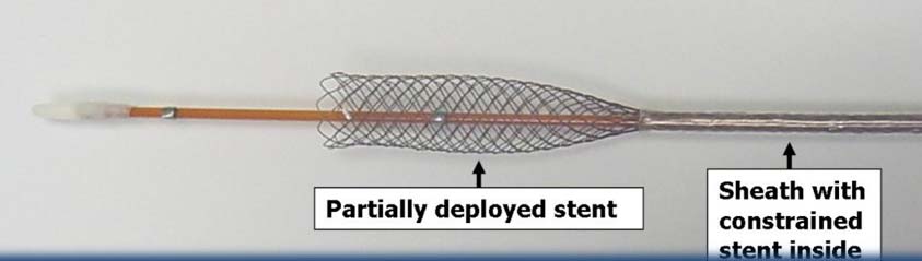 Stent